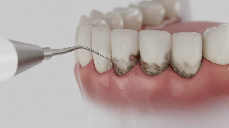 Trusted Teeth Cleaning And Checkup service in Philadelphia, MS - Dentist Open Now